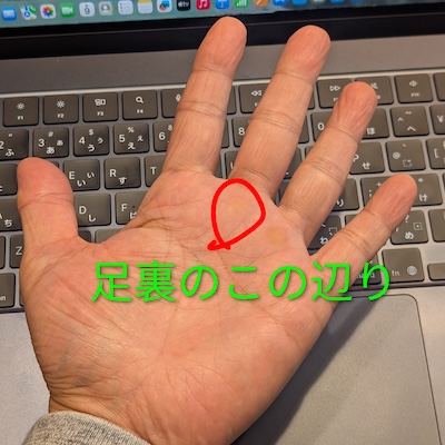 足裏に痛みが発生する場所